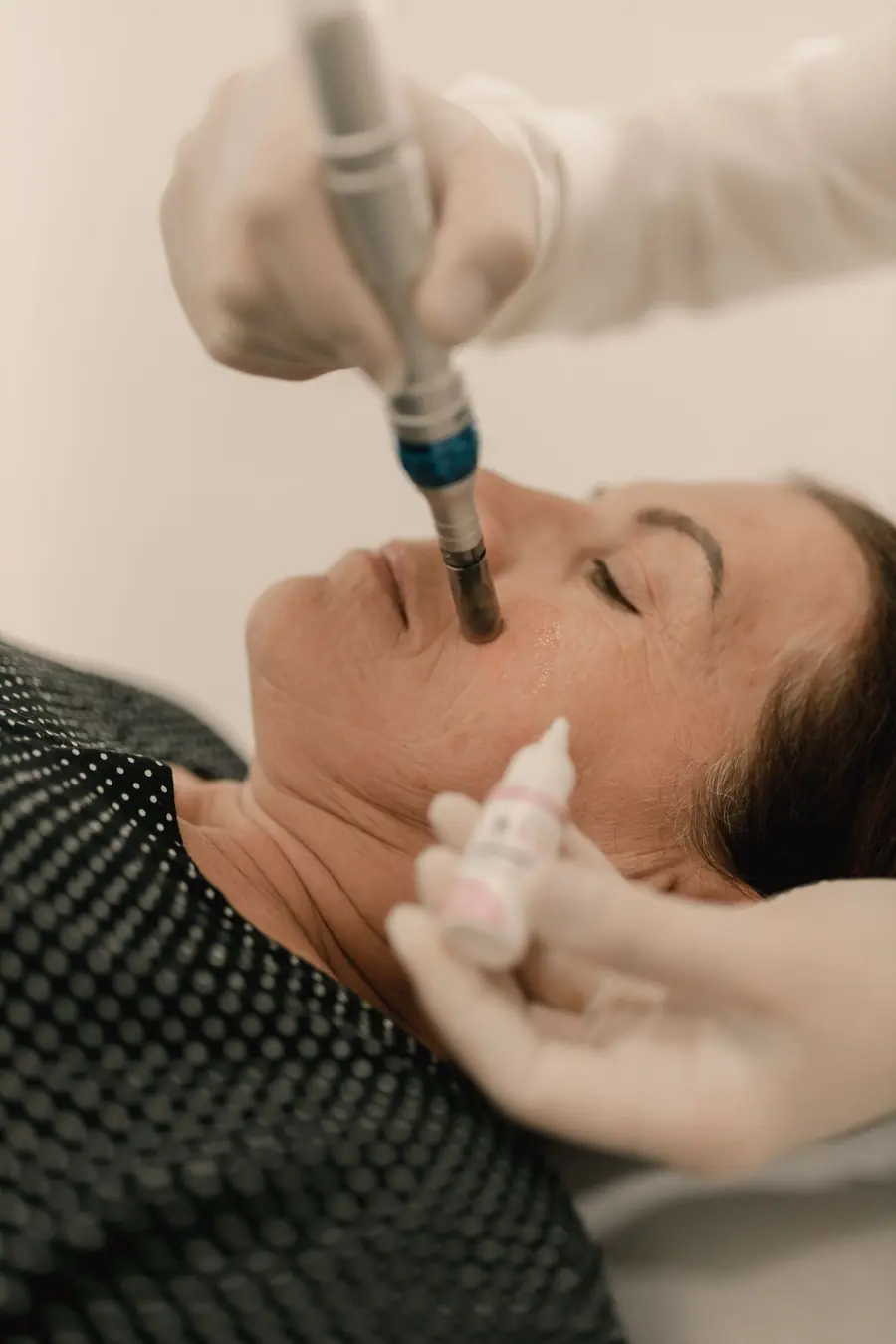 Microdermabrasion treatment at Glamsoul Beauty, Kingston upon Thames