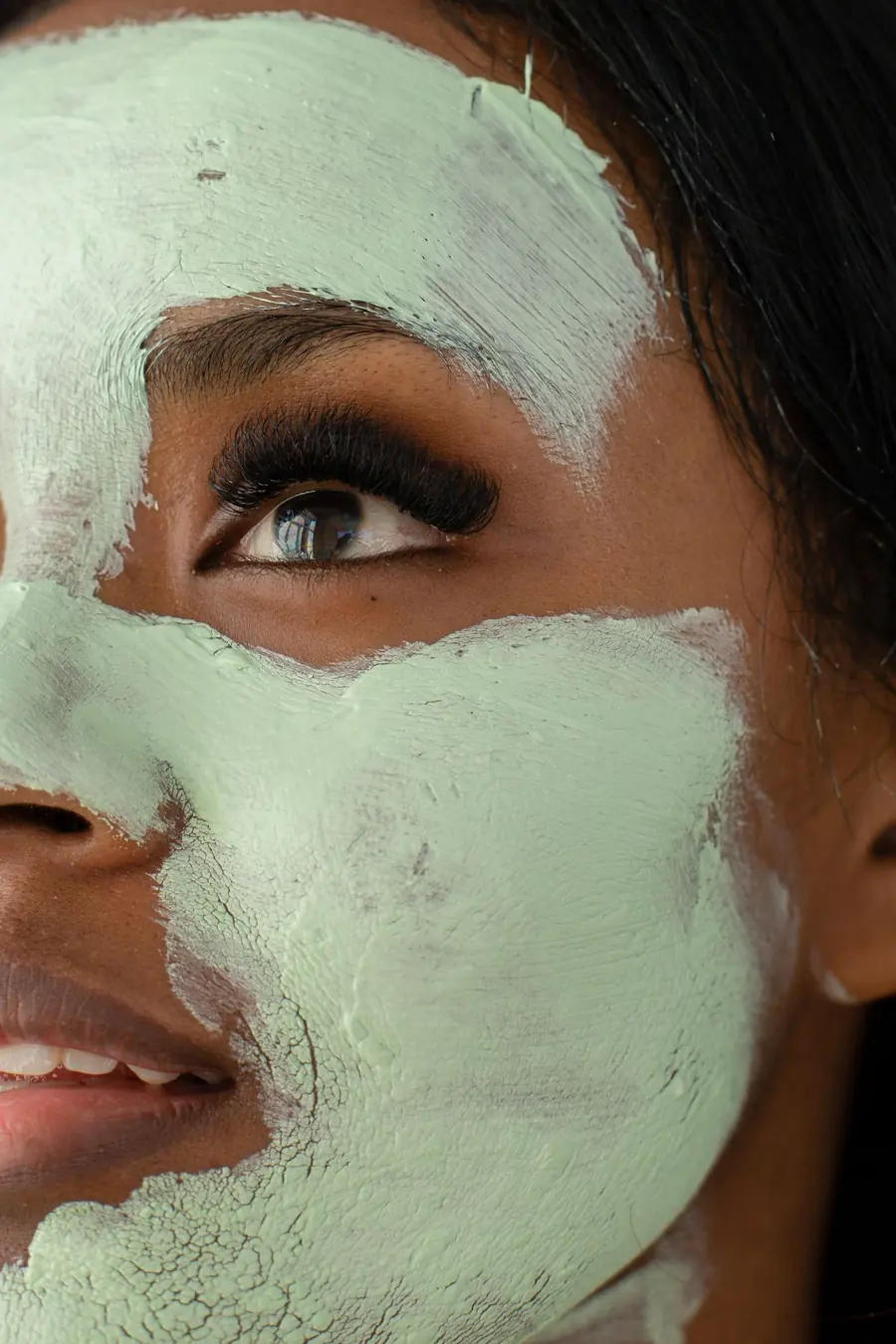 Comcit Acne Facial treatment at Glamsoul Beauty, Kingston upon Thames